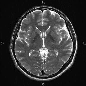 томография головного мозга в керчи